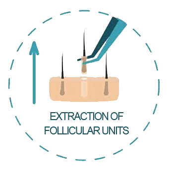 extract of follicular units