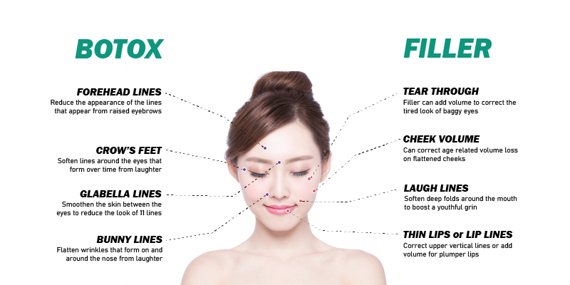 Botox VS Filler differences and usages